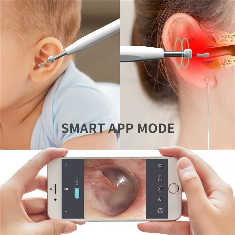 W2 Ear Camera Otoscope Ear Wax Removal Tool Kit LED Light Ear Pick Spoon Earwax Remover