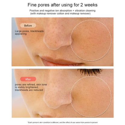 RF Face Lifting Machine EMS Pulse Therapy Device Skin Rejuvenation Micro Current Wrinkle Remover