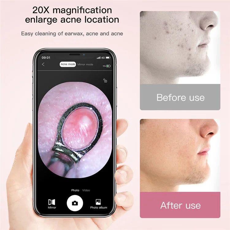 M3 20X WiFi Blackhead Remover Pore Cleaner 500W HD Visual Acne Cleaner Phone App Monitoring