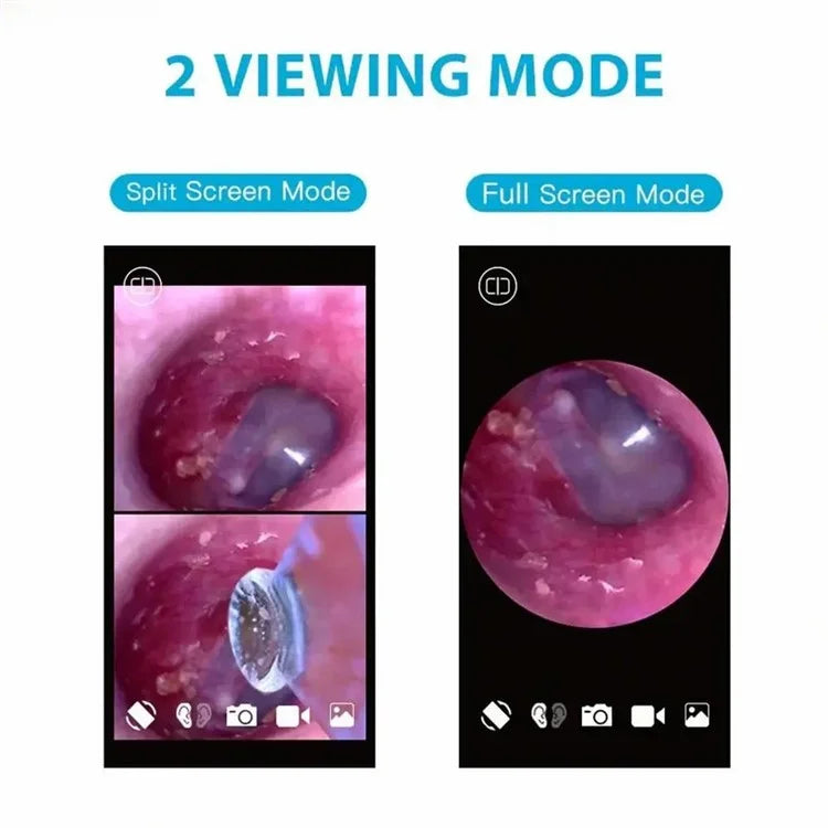 TESLONG SA39W 3.9mm WiFi Visual Otoscope Ear Endoscope Camera Ear Wax Cleaner Camera