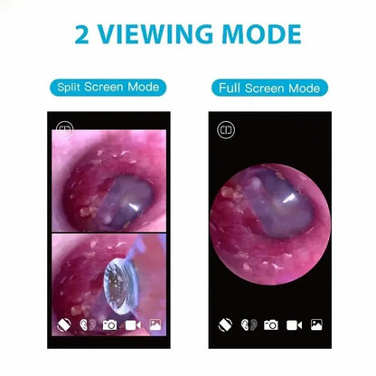 TESLONG SA39W 3.9mm WiFi Visual Otoscope Ear Endoscope Camera Ear Wax Cleaner Camera