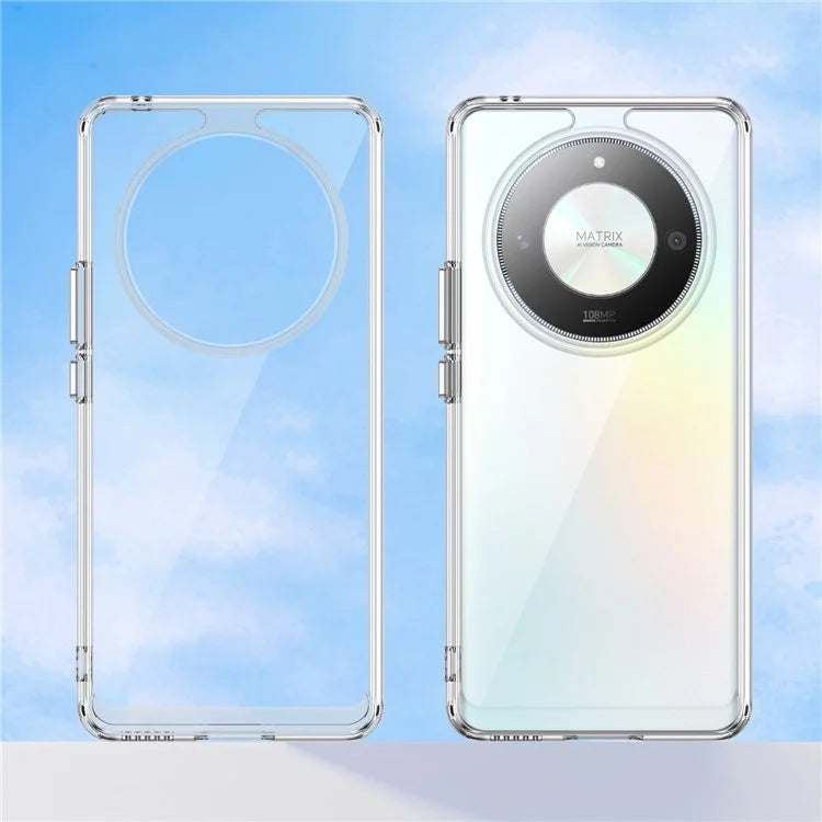 For Honor X9b 5G  /  Magic6 Lite 5G  /  X50 5G Transparent Case Electroplating Buttons (Big Rear Lens Hole)