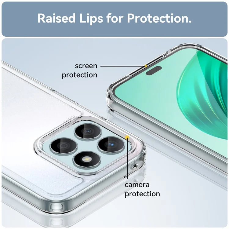 For Honor X8b 4G Clear Case Electroplating Buttons (Big Rear Lens Hole)