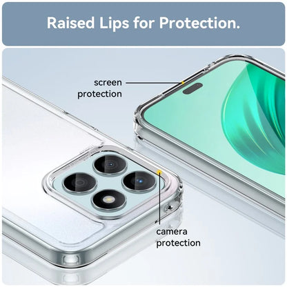 For Honor X8b 4G Clear Case Electroplating Buttons (Big Rear Lens Hole)