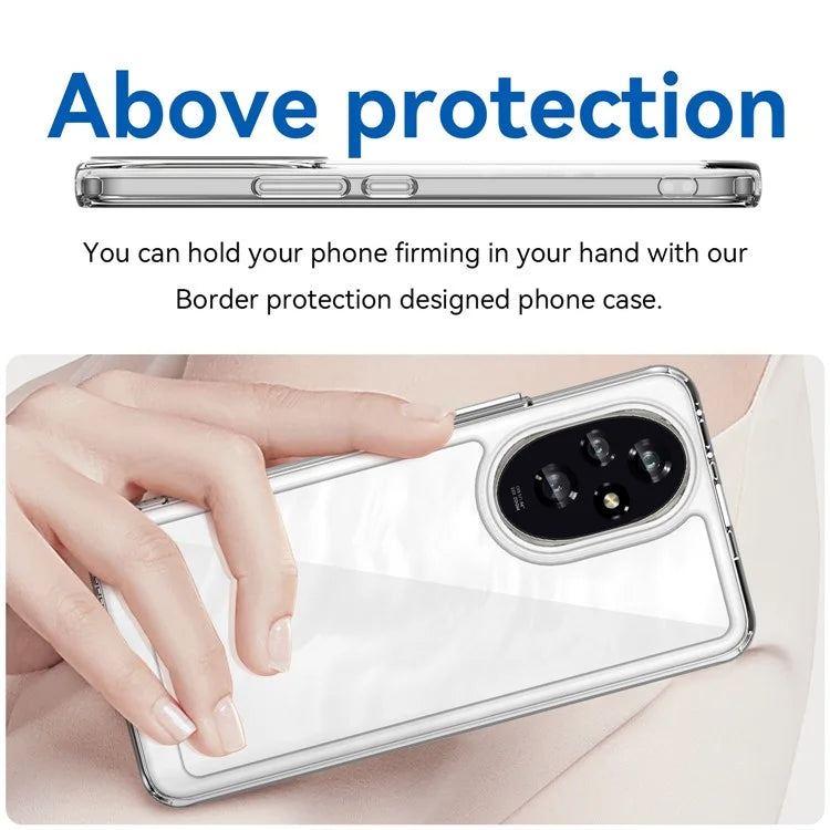 For Honor 200 5G Clear Case Electroplating Buttons (Big Rear Lens Hole)