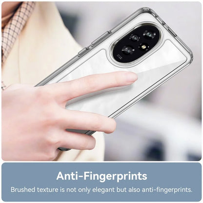 For Honor 200 5G Clear Case Electroplating Buttons (Big Rear Lens Hole)
