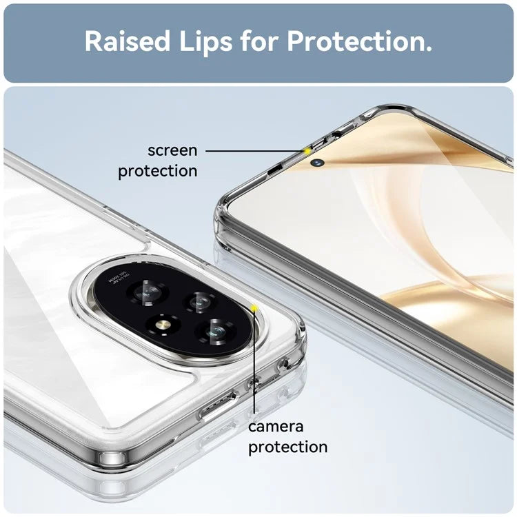 For Honor 200 5G Clear Case Electroplating Buttons (Big Rear Lens Hole)