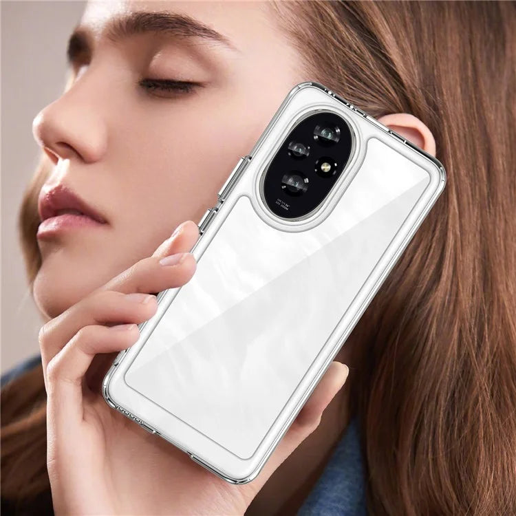 For Honor 200 5G Clear Case Electroplating Buttons (Big Rear Lens Hole)