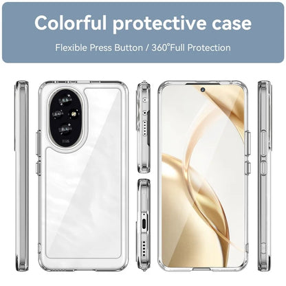 For Honor 200 5G Clear Case Electroplating Buttons (Big Rear Lens Hole)