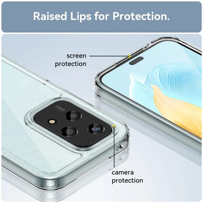 For Honor 200 Lite Transparent Case Electroplating Buttons (Big Rear Lens Hole)