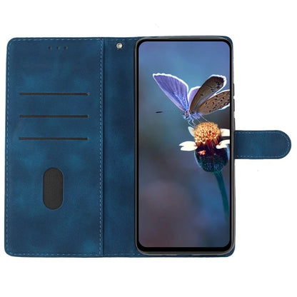 For Xiaomi Redmi Note 13 5G Case Butterfly Flower Pattern Skin-Touch Anti-Drop Leather Phone Cover