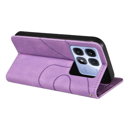 KT Leather Series-1 For Xiaomi Redmi K70 Ultra Leather Case Color Splicing Phone Cover Wallet Stand