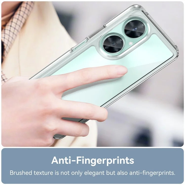 For Huawei nova 11i Case Electroplating Buttons Clear Phone Cover (Big Rear Lens Hole)