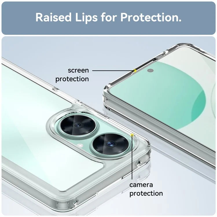 For Huawei nova 11i Case Electroplating Buttons Clear Phone Cover (Big Rear Lens Hole)