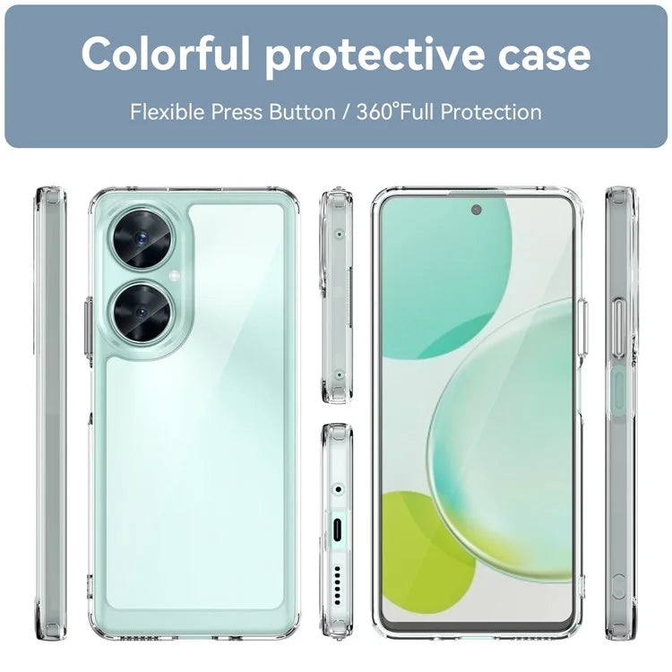 For Huawei nova 11i Case Electroplating Buttons Clear Phone Cover (Big Rear Lens Hole)