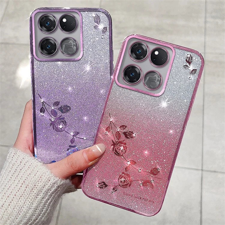 KADEM For OnePlus Ace Racing 5G Case Glitter Phone TPU Drop-proof Cover with Strap