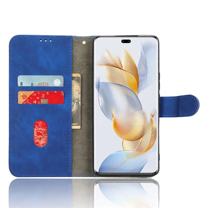 For Honor 90 Skin-Feel Flip Leather Case with Lanyard