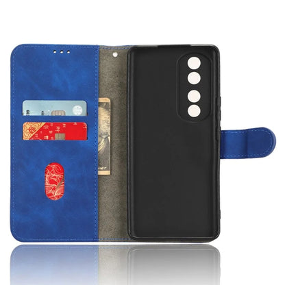 For Honor 90 Skin-Feel Flip Leather Case with Lanyard
