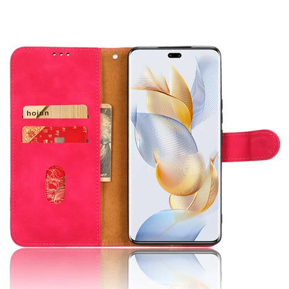 For Honor 90 Skin-Feel Flip Leather Case with Lanyard