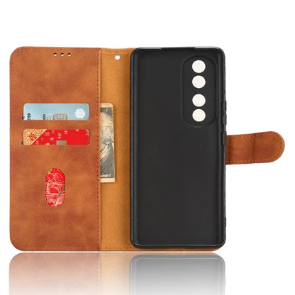For Honor 90 Skin-Feel Flip Leather Case with Lanyard