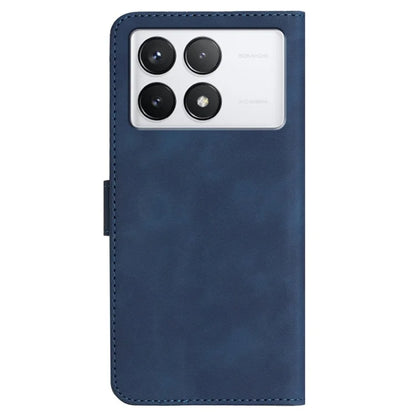 YX0030 For Xiaomi Redmi K70 5G / K70 Pro 5G Leather Case Smile Pattern Wallet Flip Cover