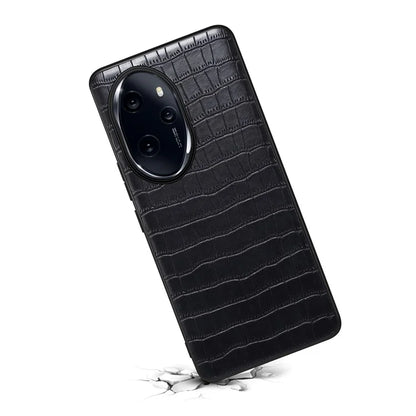 For Honor 100 Pro 5G Case Crocodile Texture Cell Phone PU Leather+PC+TPU Cover