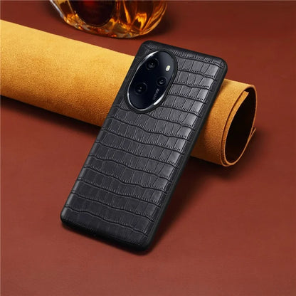 For Honor 100 Pro 5G Case Crocodile Texture Cell Phone PU Leather+PC+TPU Cover