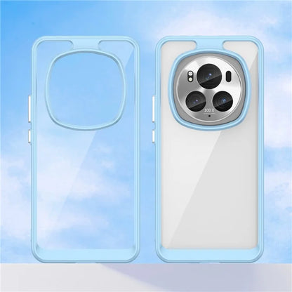 For Honor Magic6 Pro 5G TPU+Acrylic Case Transparent Back Phone Cover